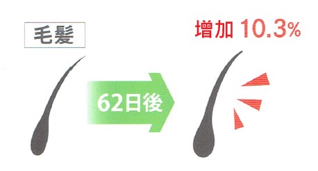 持續62天後頭髮直徑平均增加10.3%